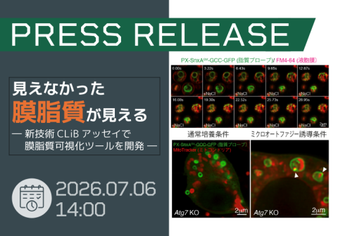 見えなかった膜脂質が見える ―新技術CLiBアッセイで膜脂質可視化ツールを開発―